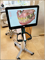 iTero Lumina Pro（アイテロ ルミナ プロ）