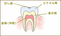 C0：脱灰